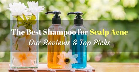 The Best Shampoo for Scalp Acne – 2021 Reviews and Top Picks