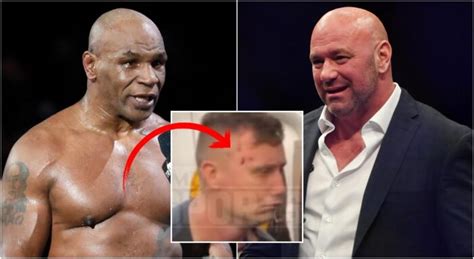 UFC Fighters And Dana White Reacts To The Mike Tyson Incident