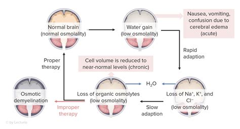 Pdf Cerebral Swelling In Severe Hyponatremia Caused By Water Hot Sex