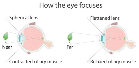 2020 Vision Louisville Normal Vision Eye Exam Ky Visionfirst