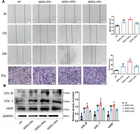 Full Article Extracellular Vesicles From Hif Overexpressing Adipose