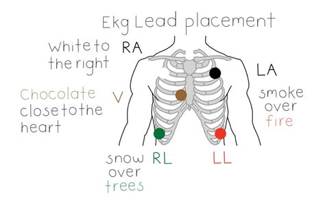 Ekg Lead Placement Ekg Leads Medical Terminology Study Nursing