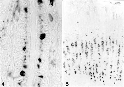 Crypt Of Duodenal Mucosa Ethanol Acetic Acid Fixation And Paraffin