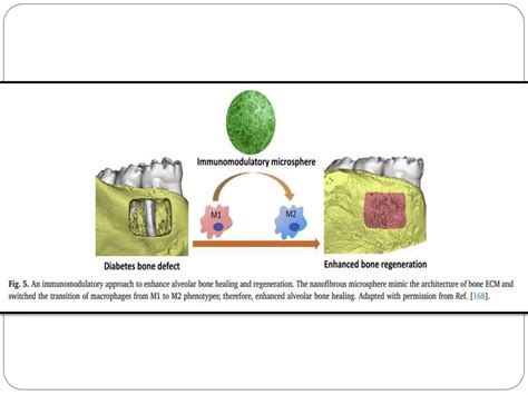 Periodontal Regeneration Current Status And Directions 5