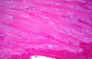 Fibrocartilage Histology