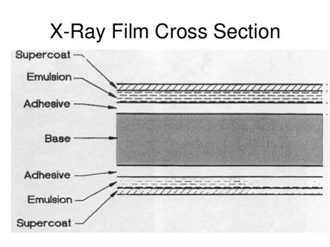 Radiographic Film And Intensifying Screens W10