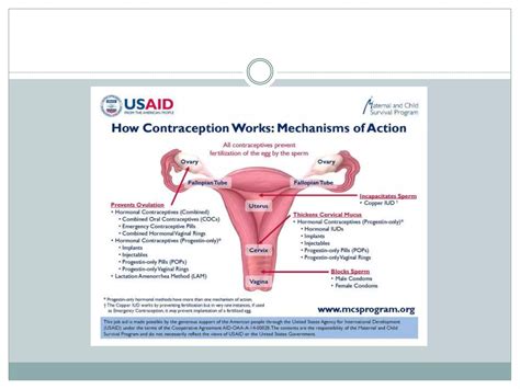 insertion of IUD devices.pptx