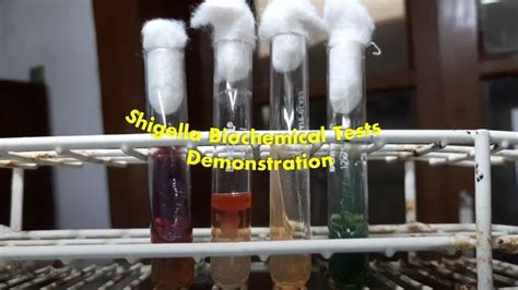 Shigella Groups Ab And C Biochemical Tests Demonstration Biochemical Voss Bottle Test