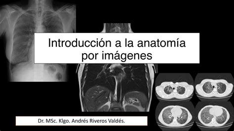 Introducción a la anatomía por imágenes mati pin uDocz