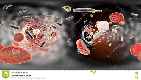 在血管里面的全景视图有细菌的 库存例证 插画 包括有 例证 传染 传记 百吉卷 医学 科学 宏指令 76948677