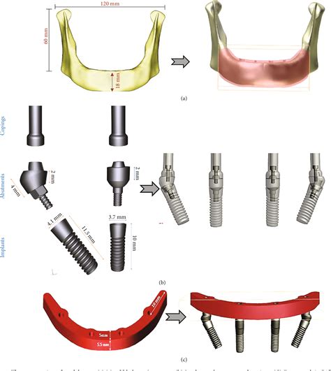 Figure 1 From Finite Element Analysis Of The Effect Of Utilizing