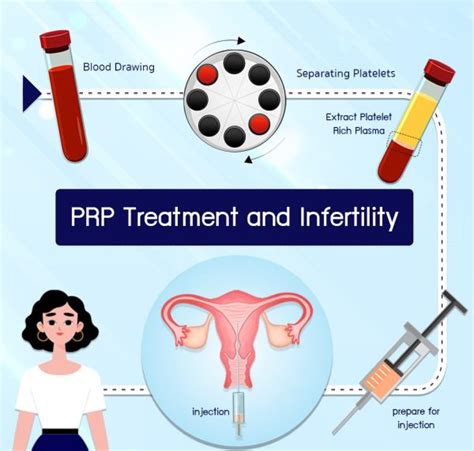 Platelet Rich Plasma Prp Delaware Institute For Reproductive Medicine