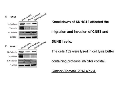 Protease Inhibitor Cocktail Edta Free X In Dmso