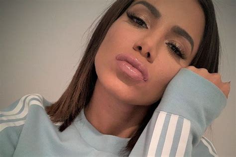 Anitta é diagnosticada estafa mental Conheça o problema Metrópoles