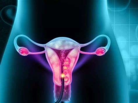 Cervical Cancer Symptoms Early Signs Of Cervical Cancer You Should