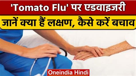 Tomato Flu से सावधान Modi Govt ने टोमैटो फ्लू को लेकर जारी की