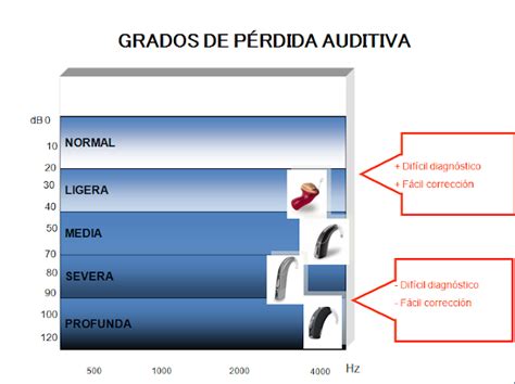 Audiòfon Balear Menorca Tipos grados y configuración de las