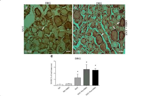 Light Photomicrographs show immunohistochemical staining of S100ß in