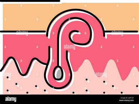 Ingrown Hair Color Icon Vector Illustration Stock Vector Image And Art