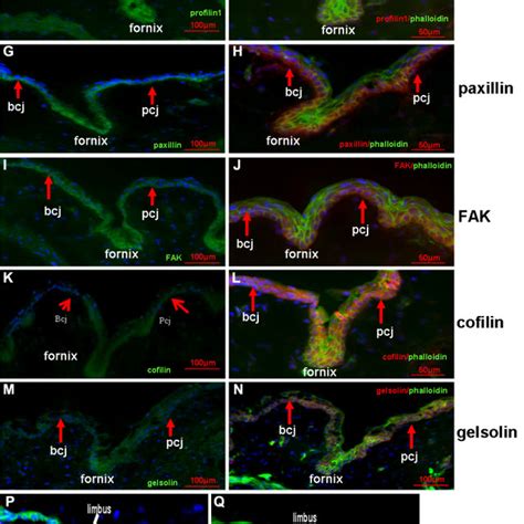 Summary of the microfilament regulators distribution in the forniceal,... | Download Scientific ...