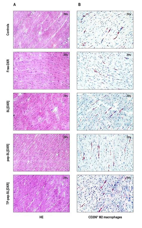 Myocardial histological sections. | Download Scientific Diagram