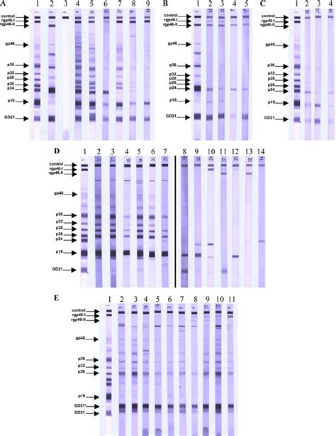 Representative Sero Reactivity Pattern Using The Mpd Htlv Blot 24 Kit