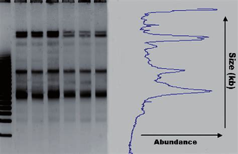 Pulsed Field Gel Electrophoresis Pfge Left Panel Showing Six Download Scientific Diagram