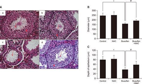 Effect Of N Acetyl L Cysteine On Testicular Tissue In Busulfan Induced