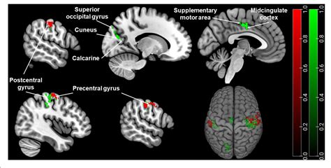 Figure 1 From Sex Differences Of Periaqueductal Grey Matter Functional