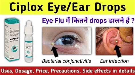 Ciplox Eye Ear Drops Uses In Hindi Ciplox Eye Drops Ciprofloxacin