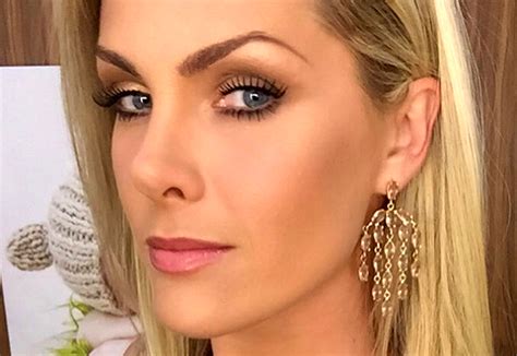 Ana Hickmann Mostra Hematomas E Chora Ao Narrar Viol Ncia Dom Stica Em