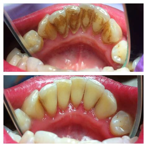 Periodontics Stomatolog Patricia