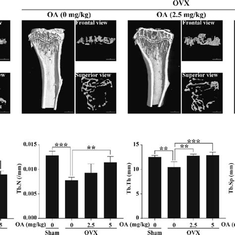 Oa Protects Ovx Induced Bone Loss In Vivo A The Micro Ct