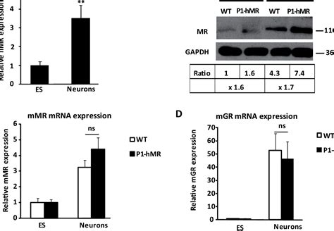 Figure 1 From Mineralocorticoid Receptor Overexpression Facilitates