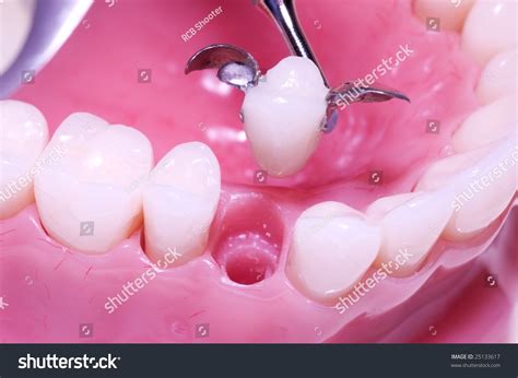 maryland bridge preparation maryland bridge model stock photo