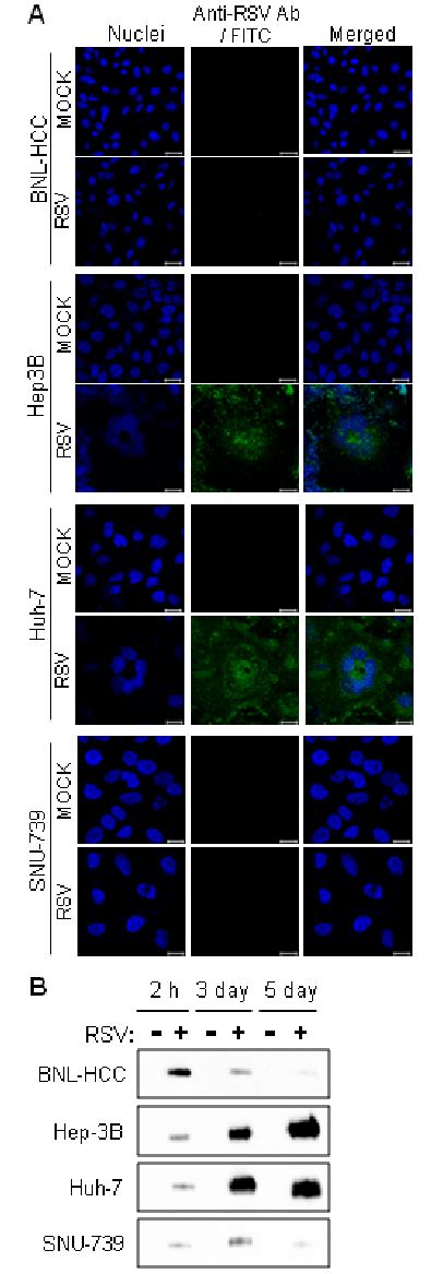 Identification Of Rsv Growth In The Cancer Cell Lines Hcc Cell Lines Download Scientific