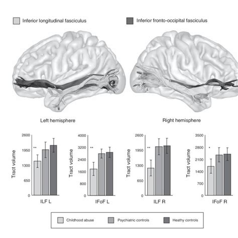 Measurements Of The Inferior Longitudinal Fasciculus And Inferior