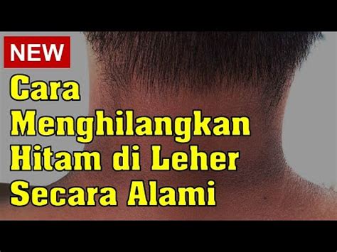 Cara Menghilangkan Hitam Di Leher Secara Alami