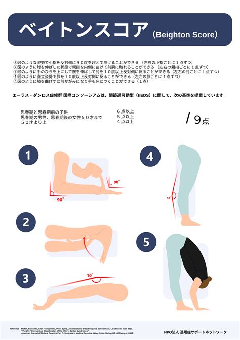 ベイトンスコア（Beighton Score）日本語訳の印刷用素材 | 過眠症サポートネットワークのブログ