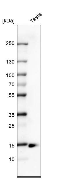 Mouse Monoclonal Anti Ctag B Antibody Buy For Research Highly