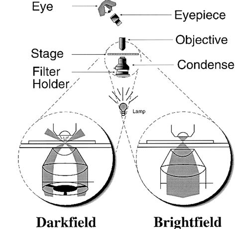 Darkfield Vs Brightfield