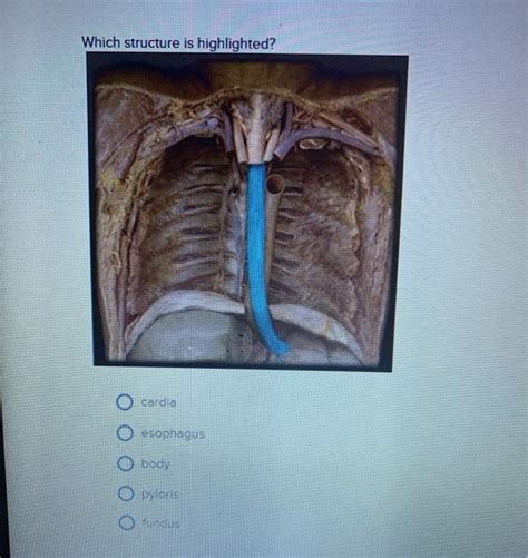 Solved Which structure is highlighted? cardia esophagus body | Chegg.com