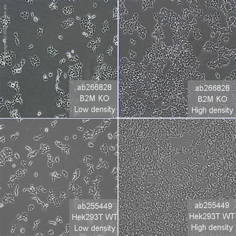 Human B2m Beta 2 Microglobulin Knockout Hek 293t Cell Line Ab266828