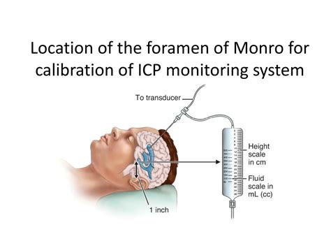 Ppt Assessment Of Neurologic Function Powerpoint Presentation Free Download Id1995439