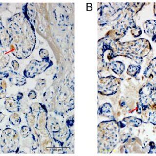 Immunohistochemical Semi Quantitative IOD Values Of Placental Tissues