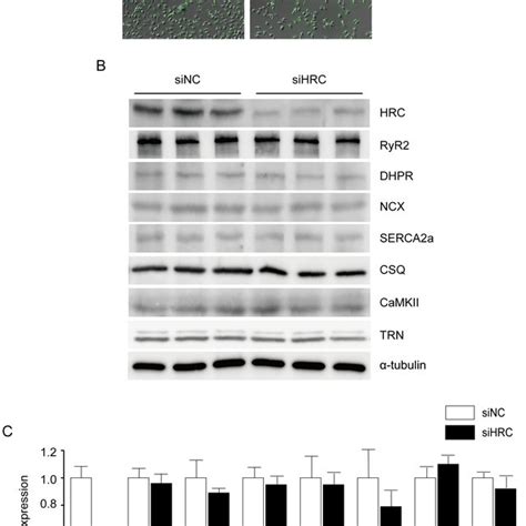 Sirna Mediated Hrc Knock Down Kd And The Expressional Profiles Of Sr