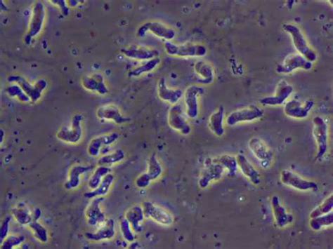 Photos Of Naegleria Fowleri Naegleria Fowleri Cdc