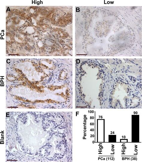 Expression Of Leucine Rich Pentatricopeptide Repeat Motif Containing