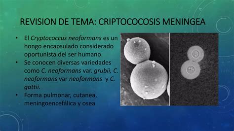 Criptococosis Meningea PPT