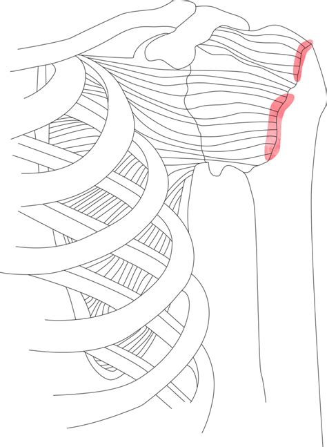 Rotator Cuff Tear Gloucestershire Shoulder Clinic